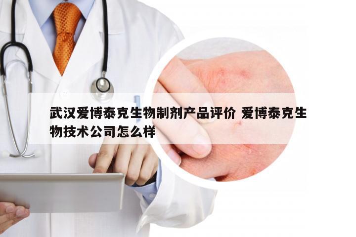 武汉爱博泰克生物制剂产品评价 爱博泰克生物技术公司怎么样