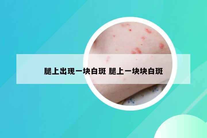 腿上出现一块白斑 腿上一块块白斑