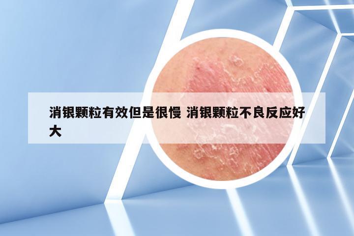 消银颗粒有效但是很慢 消银颗粒不良反应好大