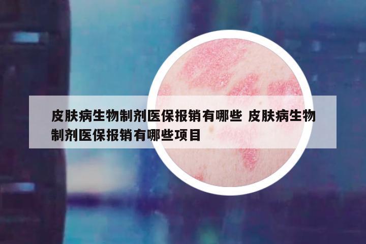 皮肤病生物制剂医保报销有哪些 皮肤病生物制剂医保报销有哪些项目