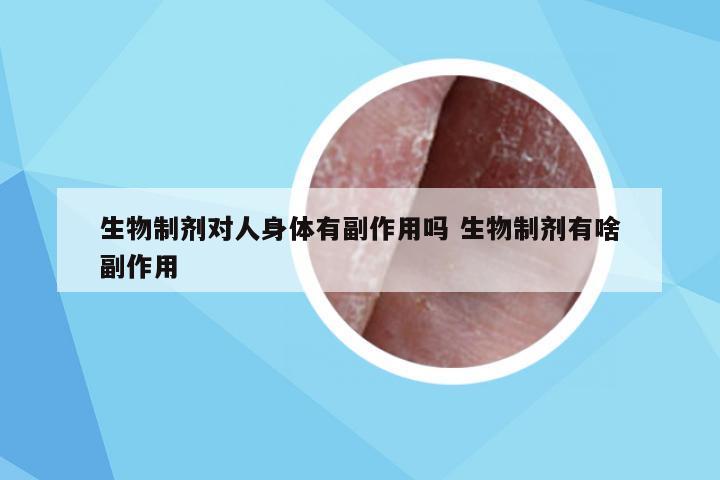 生物制剂对人身体有副作用吗 生物制剂有啥副作用