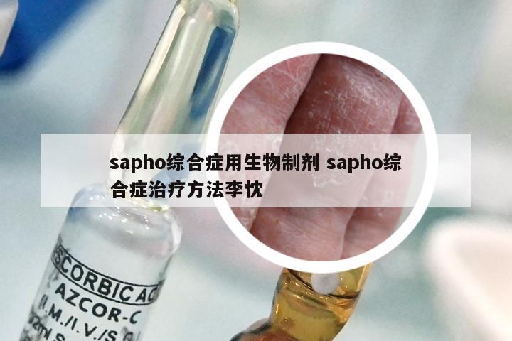 sapho综合症用生物制剂 sapho综合症治疗方法李忱
