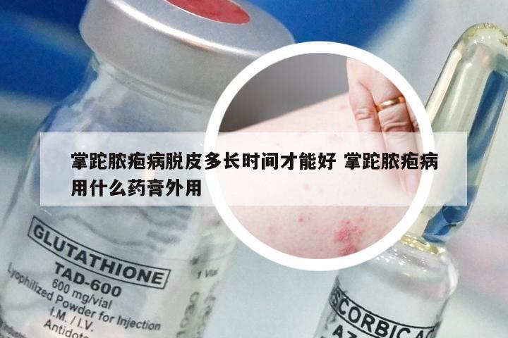 掌跎脓疱病脱皮多长时间才能好 掌跎脓疱病用什么药膏外用