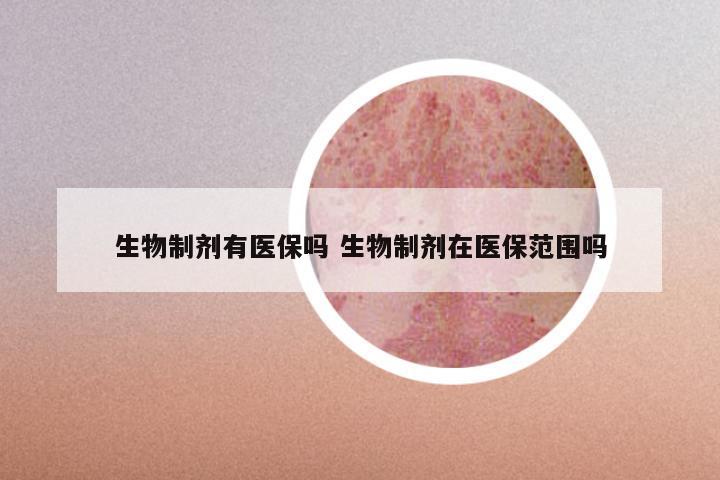 生物制剂有医保吗 生物制剂在医保范围吗