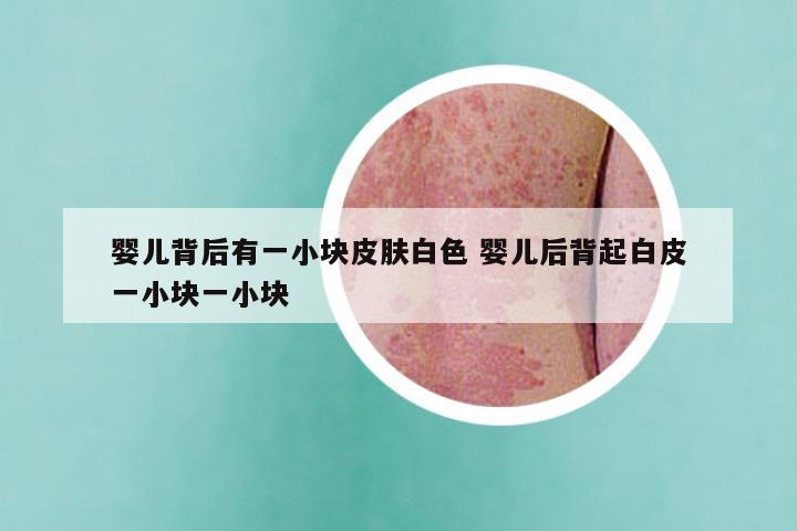 婴儿背后有一小块皮肤白色 婴儿后背起白皮一小块一小块