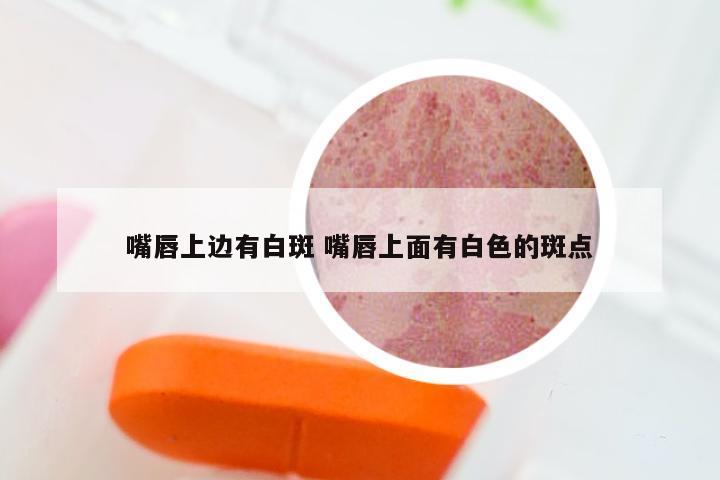 嘴唇上边有白斑 嘴唇上面有白色的斑点