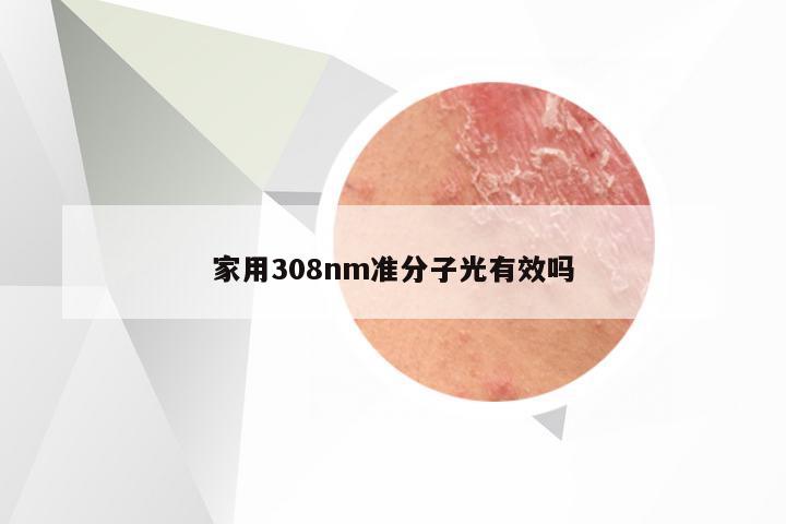 家用308nm准分子光有效吗