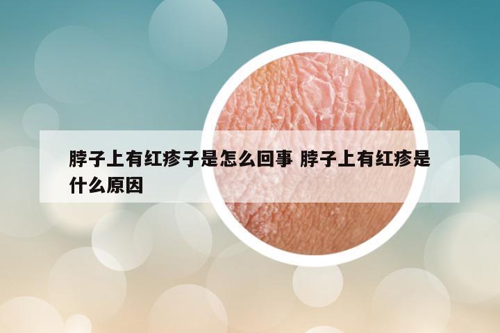 脖子上有红疹子是怎么回事 脖子上有红疹是什么原因
