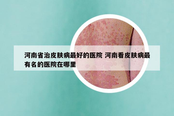 河南省治皮肤病最好的医院 河南看皮肤病最有名的医院在哪里
