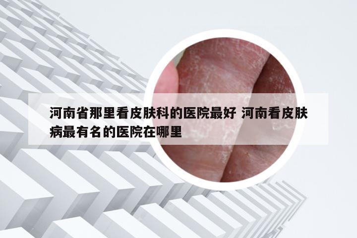 河南省那里看皮肤科的医院最好 河南看皮肤病最有名的医院在哪里