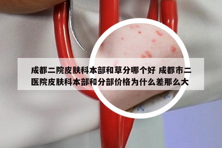 成都二院皮肤科本部和草分哪个好 成都市二医院皮肤科本部和分部价格为什么差那么大
