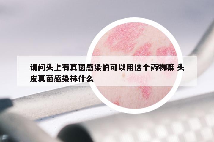 请问头上有真菌感染的可以用这个药物嘛 头皮真菌感染抹什么