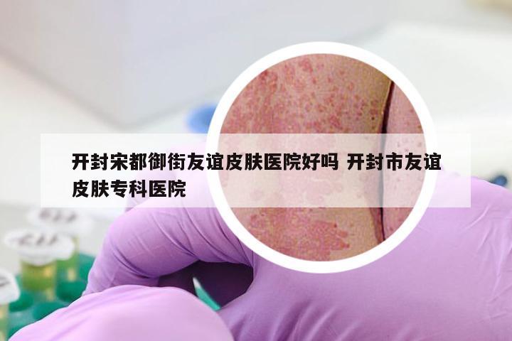 开封宋都御街友谊皮肤医院好吗 开封市友谊皮肤专科医院