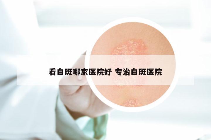 看白斑哪家医院好 专治白斑医院
