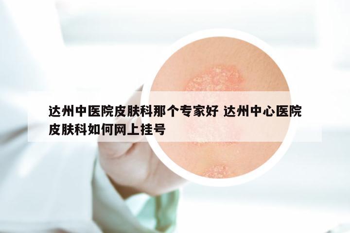 达州中医院皮肤科那个专家好 达州中心医院皮肤科如何网上挂号