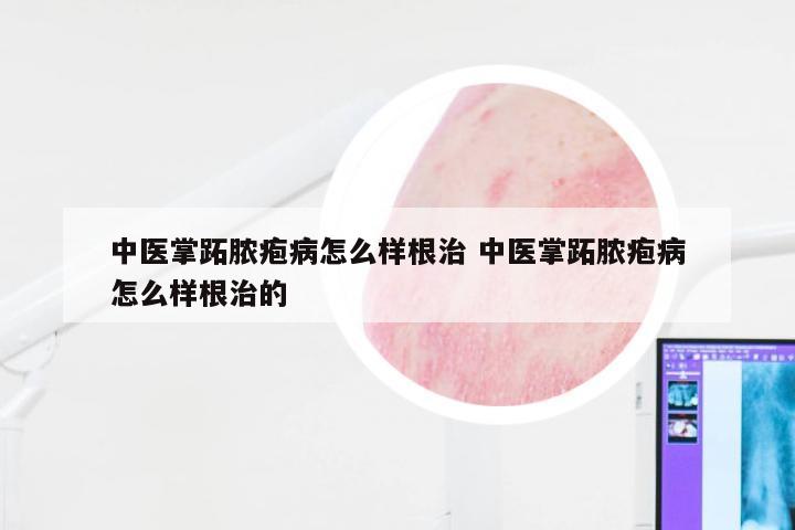 中医掌跖脓疱病怎么样根治 中医掌跖脓疱病怎么样根治的