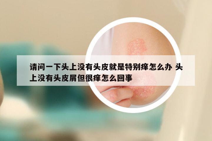 请问一下头上没有头皮就是特别痒怎么办 头上没有头皮屑但很痒怎么回事