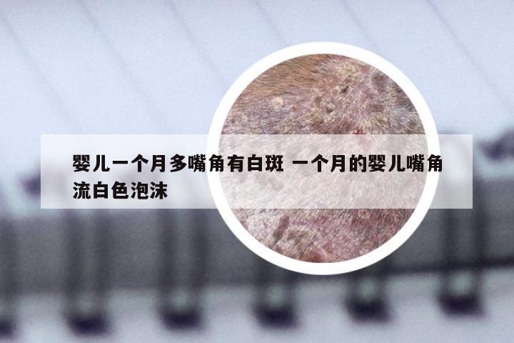 婴儿一个月多嘴角有白斑 一个月的婴儿嘴角流白色泡沫