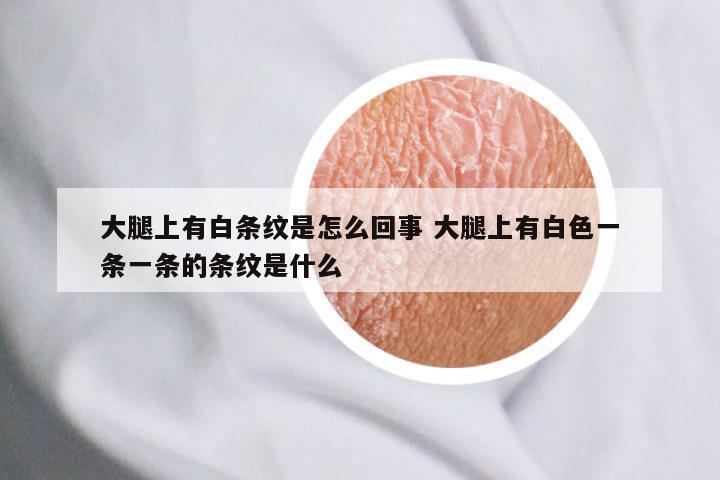 大腿上有白条纹是怎么回事 大腿上有白色一条一条的条纹是什么