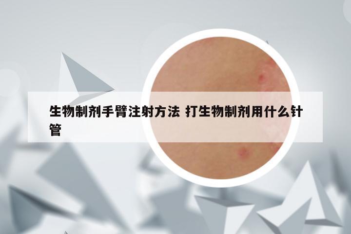 生物制剂手臂注射方法 打生物制剂用什么针管