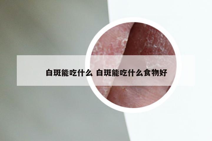 白斑能吃什么 白斑能吃什么食物好