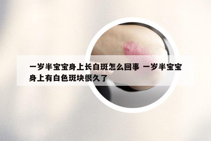 一岁半宝宝身上长白斑怎么回事 一岁半宝宝身上有白色斑块很久了