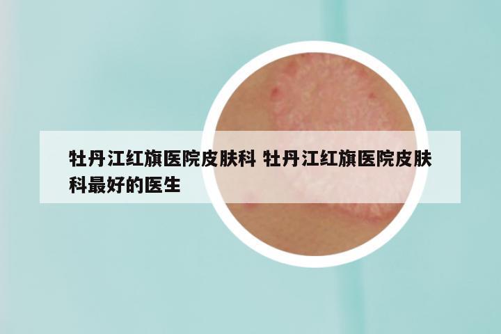 牡丹江红旗医院皮肤科 牡丹江红旗医院皮肤科最好的医生