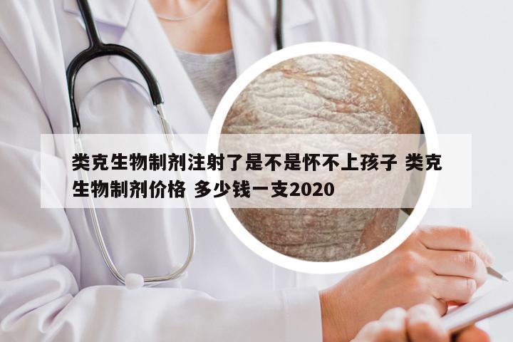 类克生物制剂注射了是不是怀不上孩子 类克生物制剂价格 多少钱一支2020