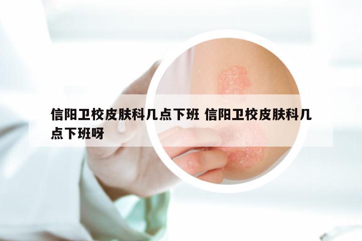 信阳卫校皮肤科几点下班 信阳卫校皮肤科几点下班呀