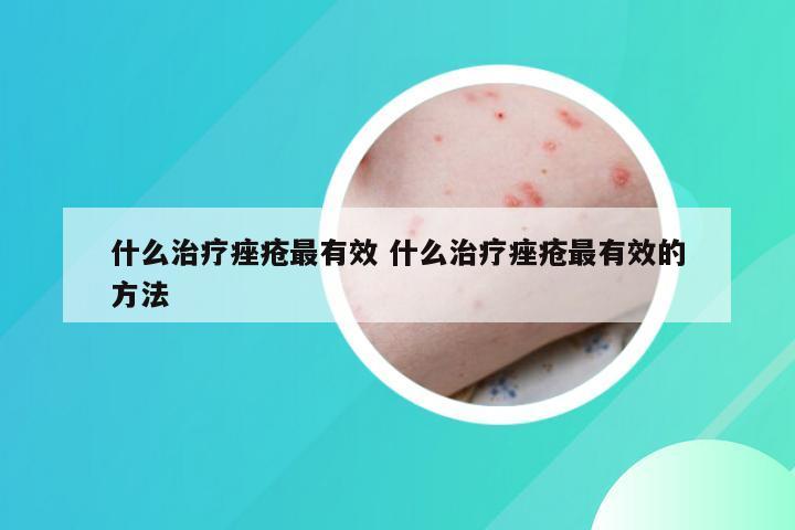 什么治疗痤疮最有效 什么治疗痤疮最有效的方法