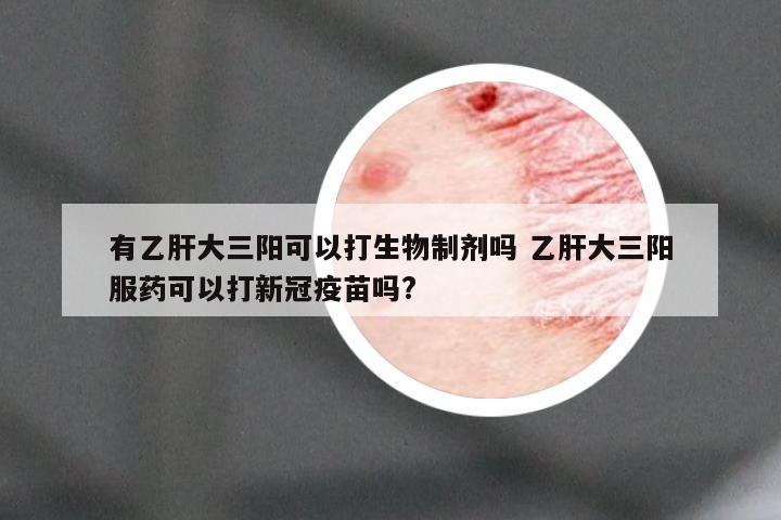 有乙肝大三阳可以打生物制剂吗 乙肝大三阳服药可以打新冠疫苗吗?