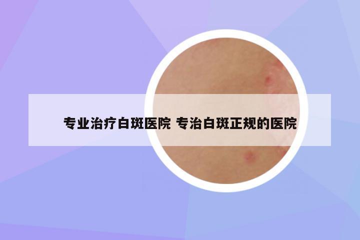 专业治疗白斑医院 专治白斑正规的医院