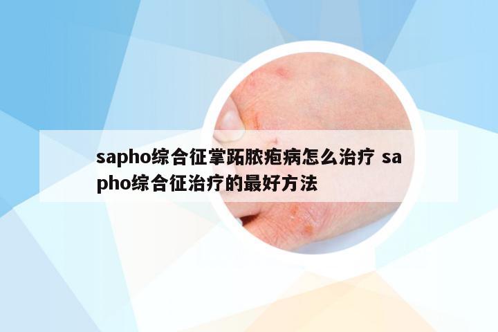 sapho综合征掌跖脓疱病怎么治疗 sapho综合征治疗的最好方法