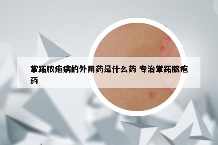 掌跖脓疱病的外用药是什么药 专治掌跖脓疱药