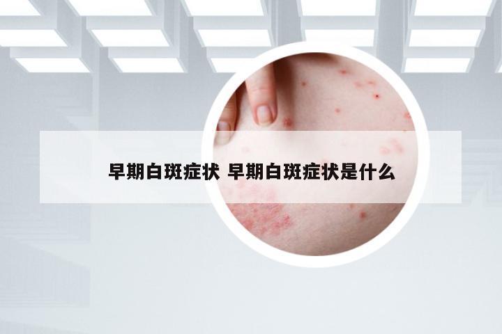 早期白斑症状 早期白斑症状是什么