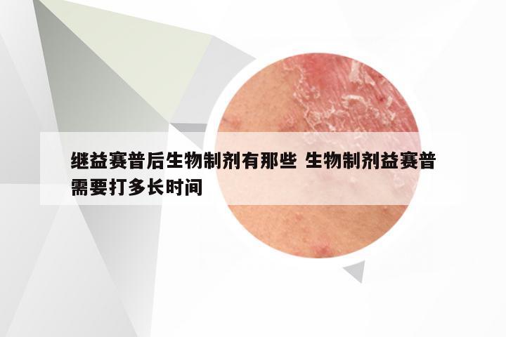 继益赛普后生物制剂有那些 生物制剂益赛普需要打多长时间