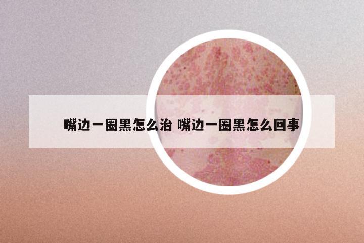 嘴边一圈黑怎么治 嘴边一圈黑怎么回事