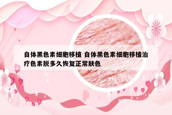 自体黑色素细胞移植 自体黑色素细胞移植治疗色素脱多久恢复正常肤色