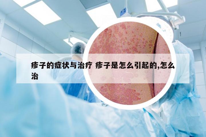 疹子的症状与治疗 疹子是怎么引起的,怎么治