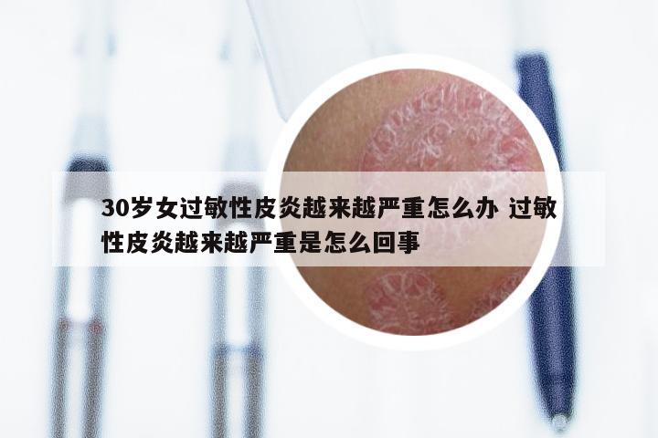 30岁女过敏性皮炎越来越严重怎么办 过敏性皮炎越来越严重是怎么回事