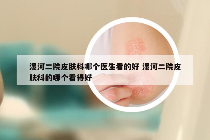 漯河二院皮肤科哪个医生看的好 漯河二院皮肤科的哪个看得好