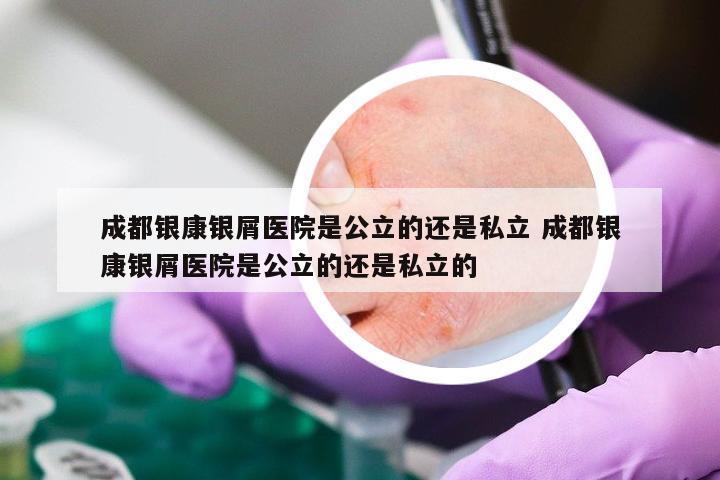 成都银康银屑医院是公立的还是私立 成都银康银屑医院是公立的还是私立的