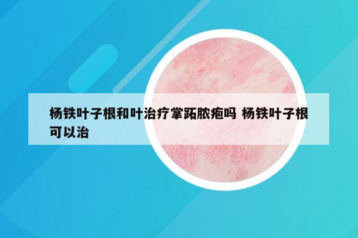杨铁叶子根和叶治疗掌跖脓疱吗 杨铁叶子根可以治