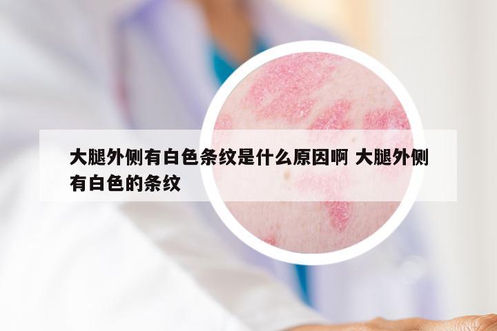 大腿外侧有白色条纹是什么原因啊 大腿外侧有白色的条纹