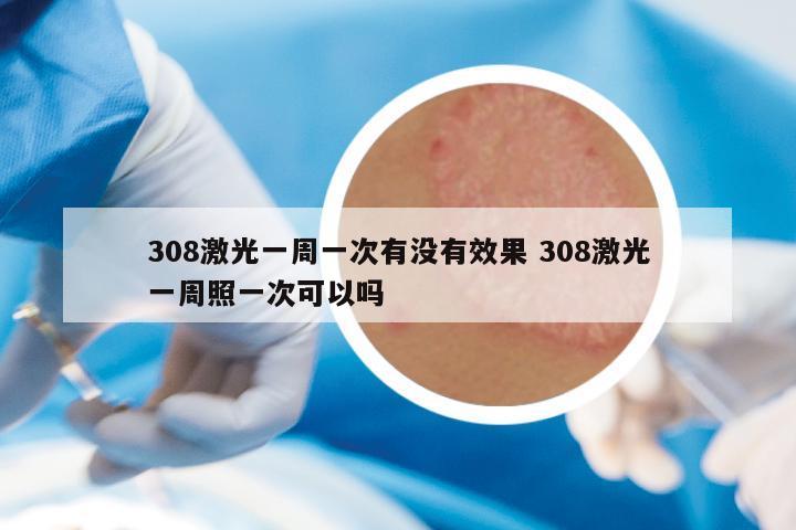 308激光一周一次有没有效果 308激光一周照一次可以吗