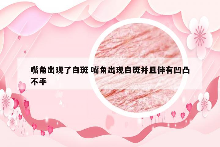 嘴角出现了白斑 嘴角出现白斑并且伴有凹凸不平