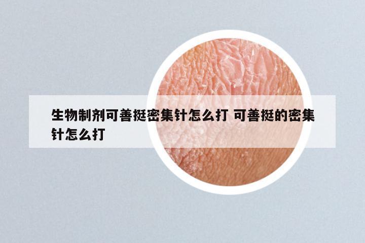 生物制剂可善挺密集针怎么打 可善挺的密集针怎么打
