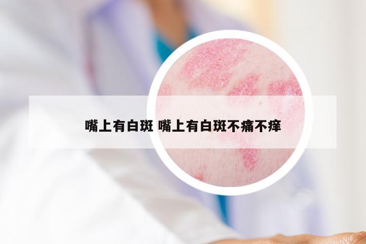 嘴上有白斑 嘴上有白斑不痛不痒