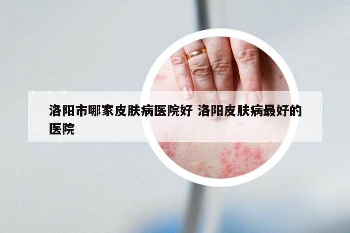 洛阳市哪家皮肤病医院好 洛阳皮肤病最好的医院
