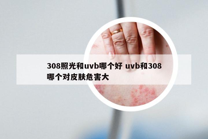 308照光和uvb哪个好 uvb和308哪个对皮肤危害大